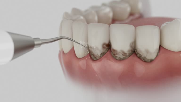 Reliable Dental Implants contractor in Girard, PA by Smile Center Dentistry